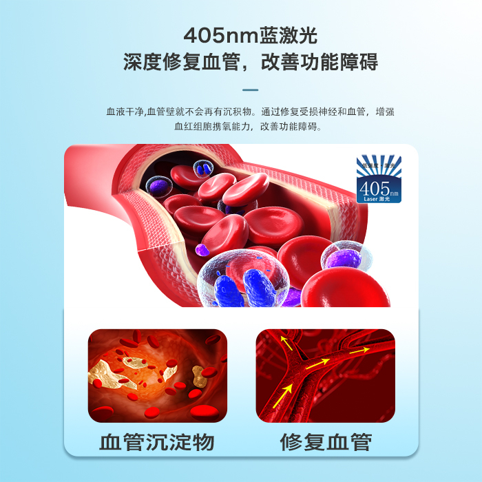 為什么說(shuō)405納米藍(lán)激光能修復(fù)血管？原理是什么？