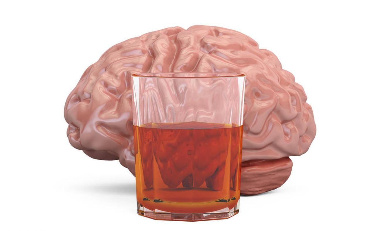 酒精和大腦.jpg